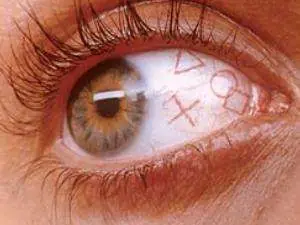 Ojos