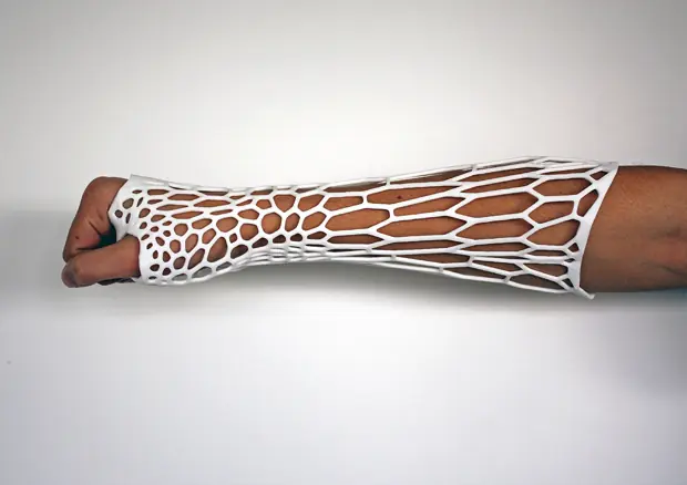 Cortex Cast: un exoesqueleto reciclable para curar fracturas