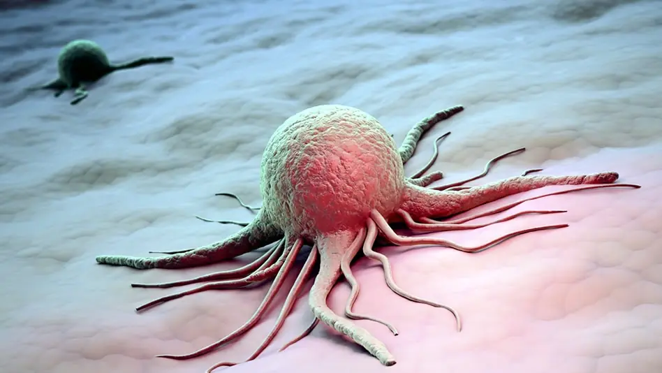 como prevenir el cancer