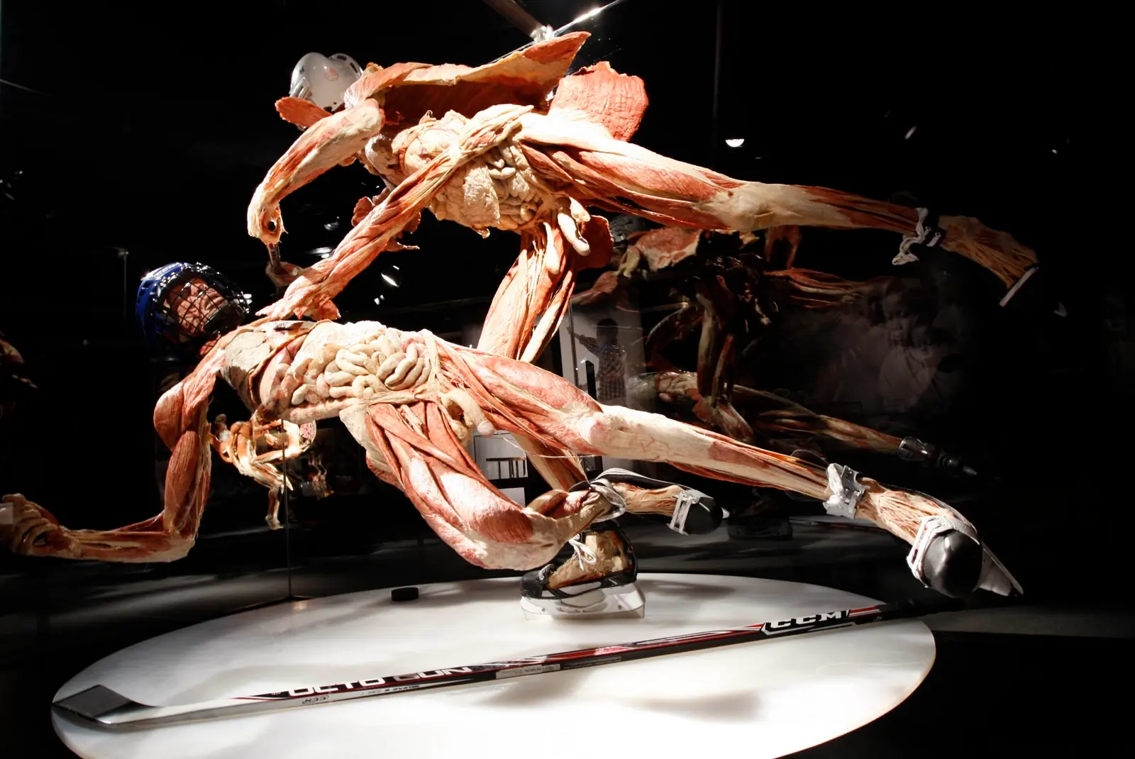 Plastinacion