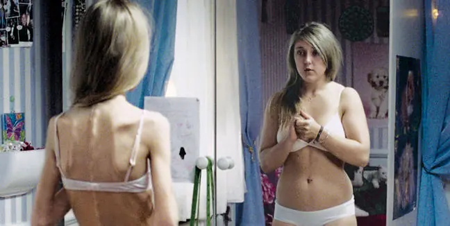 La alimentación, en problemas: la comida como síntoma