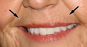 ps