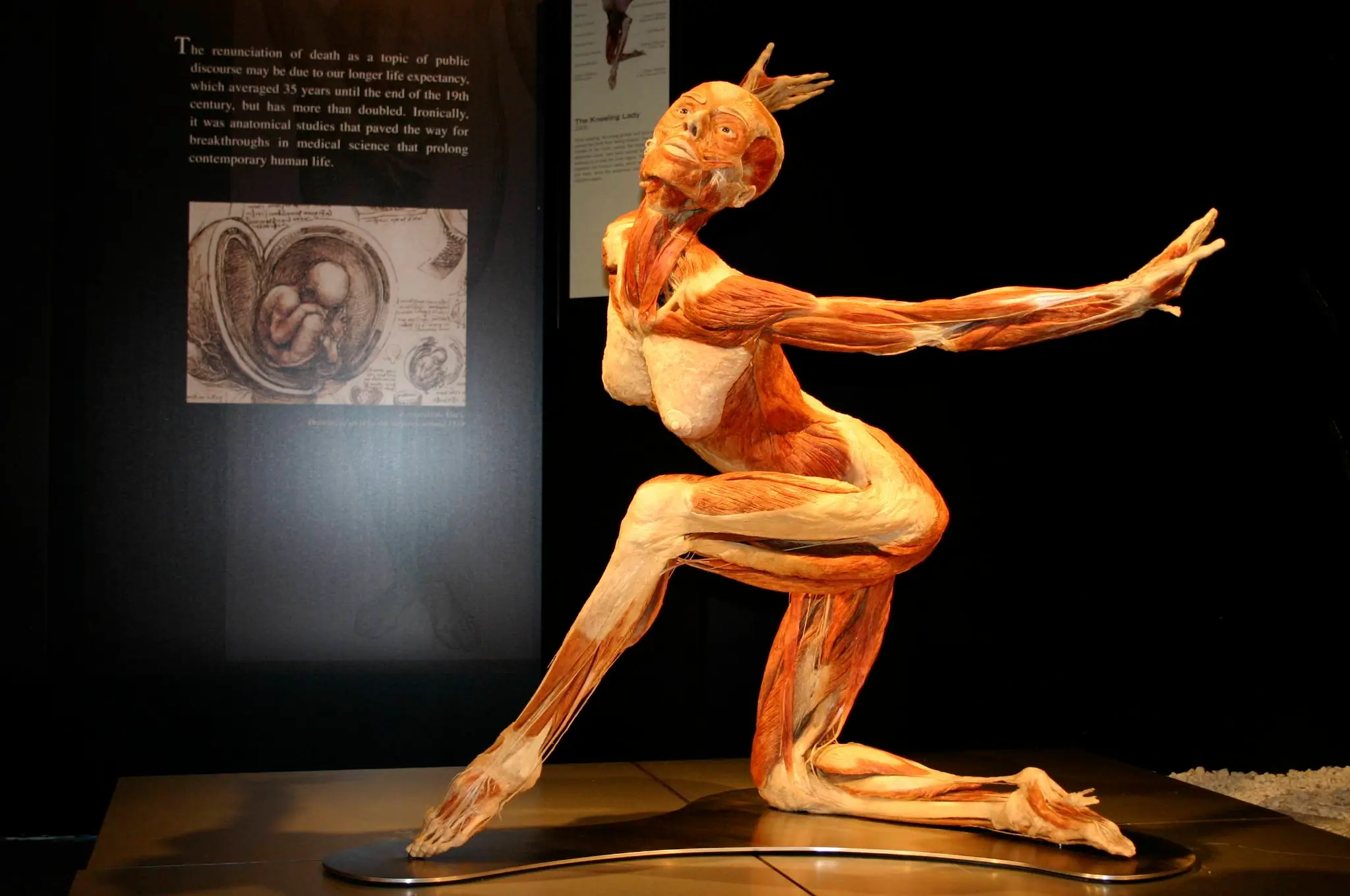 Plastinacion