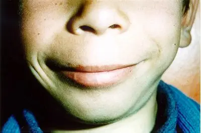 Beber alcohol durante el embarazo.