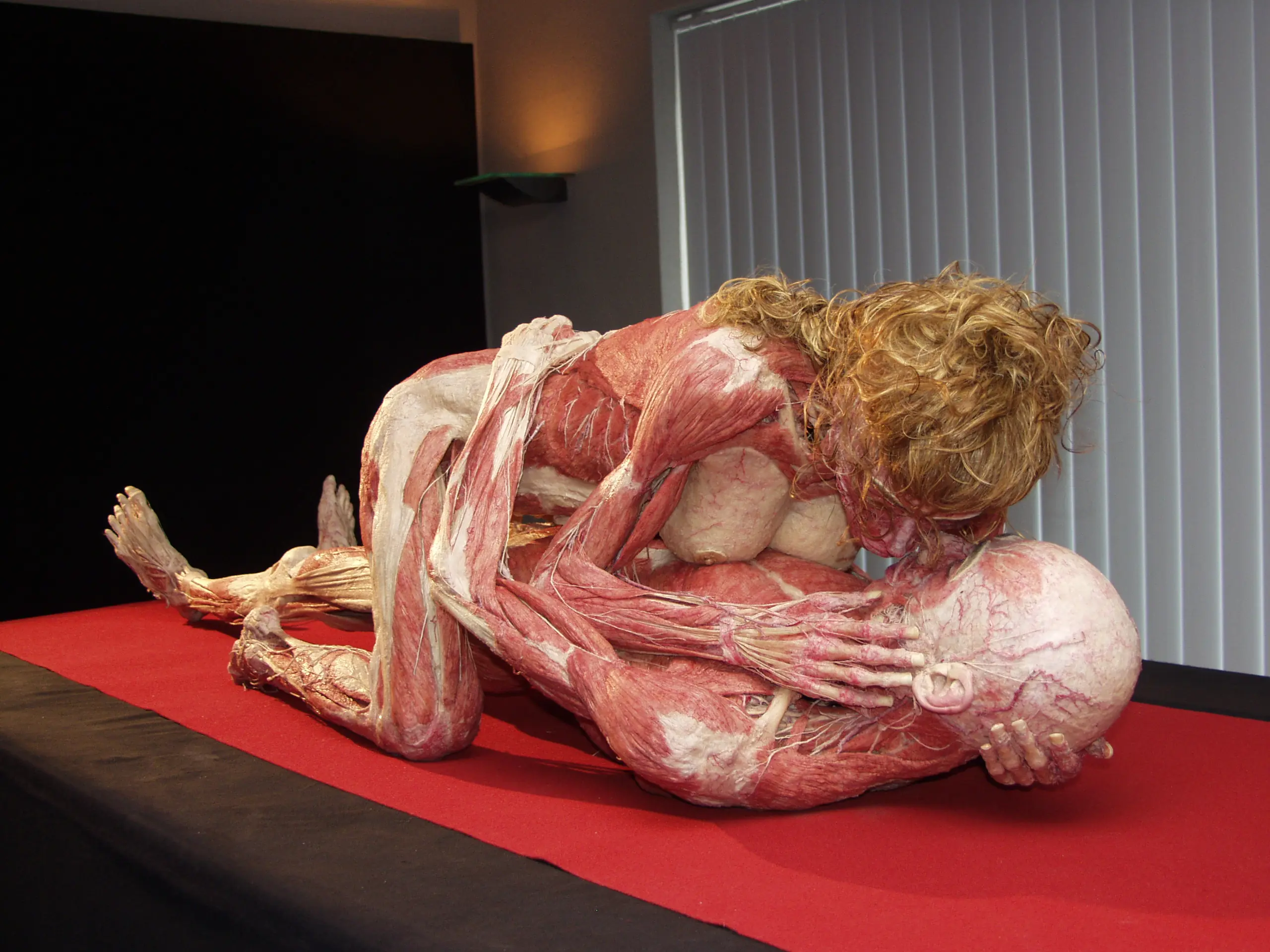 Plastinacion