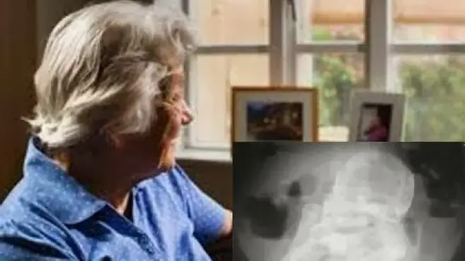 Una anciana de 84 años está “embarazada” hace 44 años