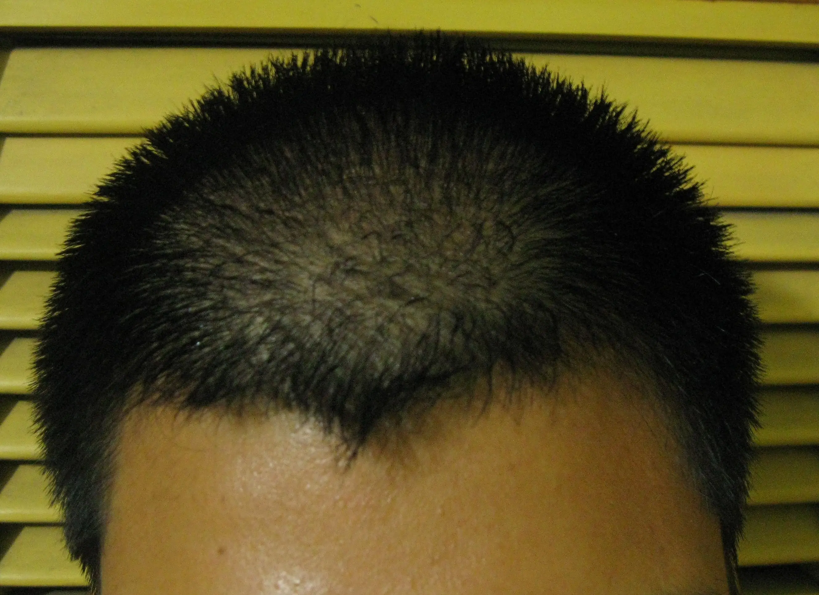 [Experimento cavernícola] El hombre que no usa shampoo: (0)