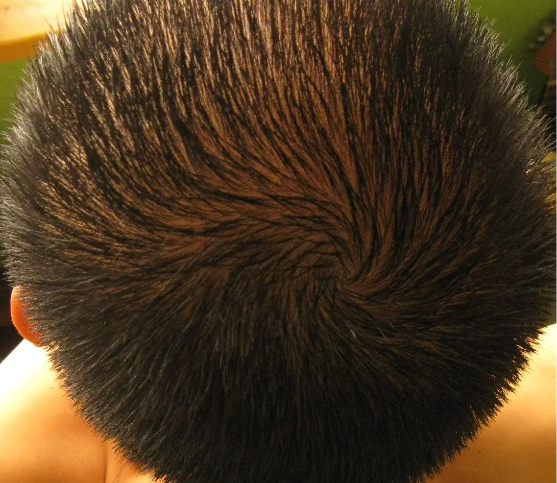 [Experimento cavernícola] El hombre que no usa shampoo (-1)