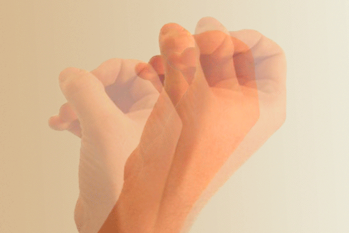 Bolas moradas ¿Te ha pasado?