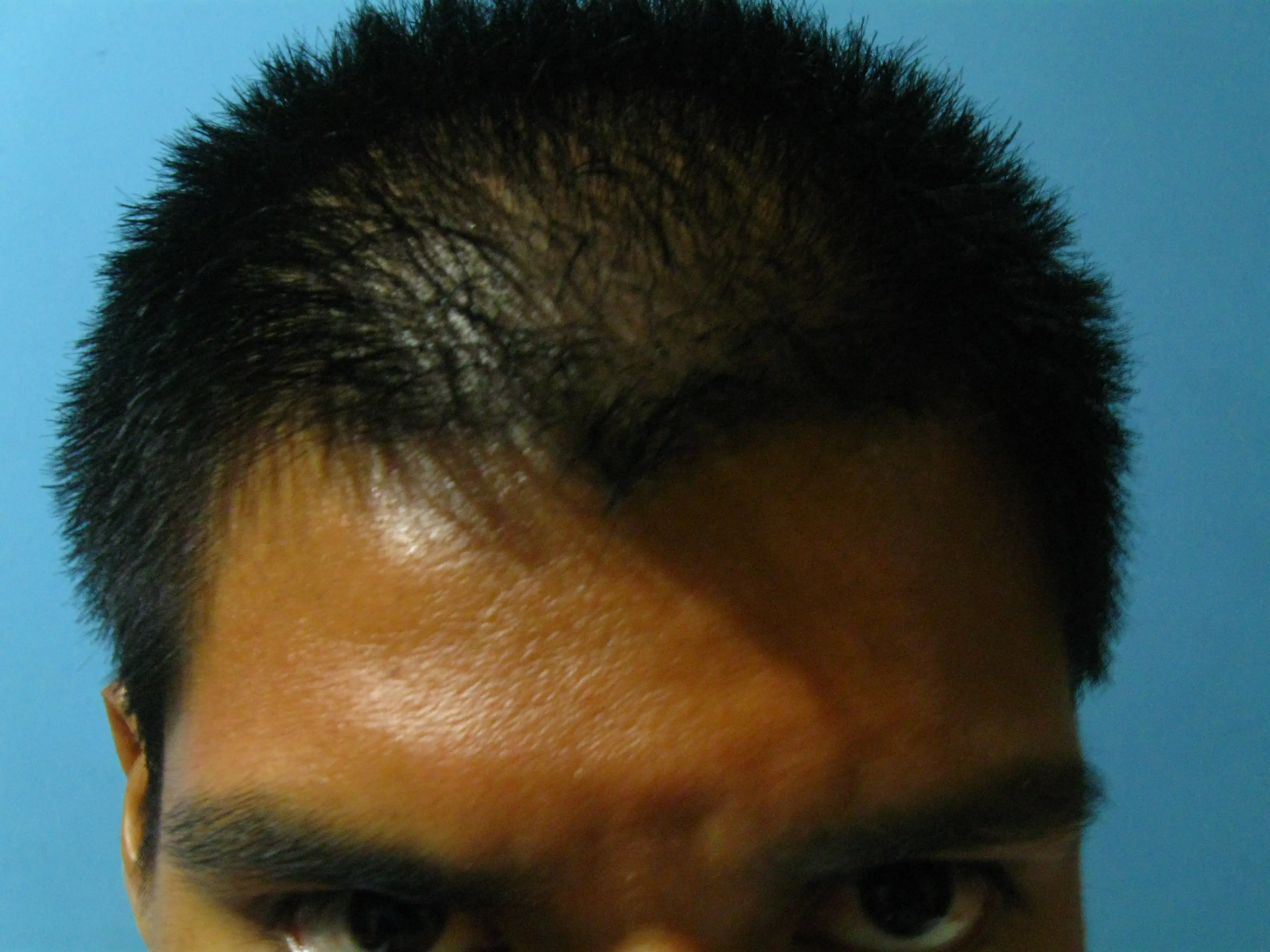 [Experimento cavernícola] El hombre que no usa shampoo: (4)