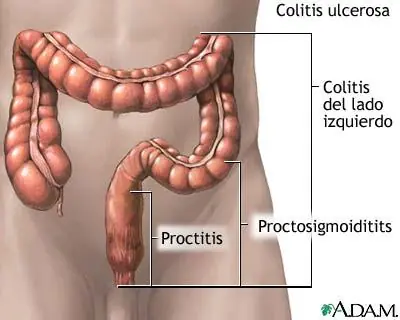Colon