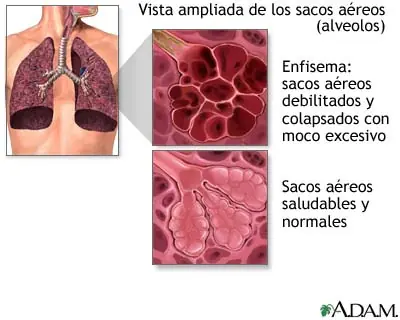 fumadores