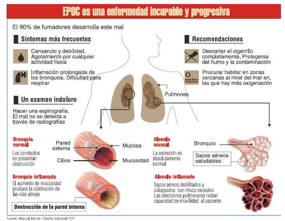 ¿Qué es la Epoc?