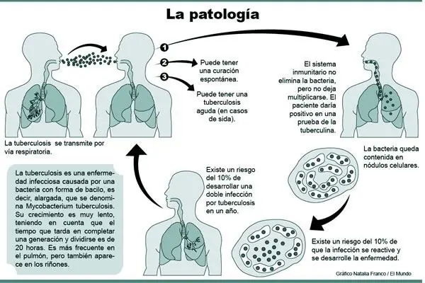 primeros auxilios