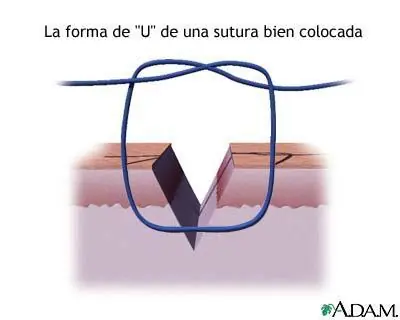 primeros auxilios