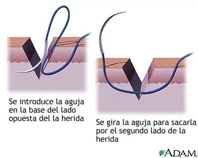 sistemas