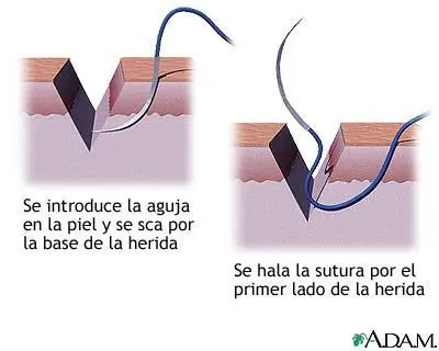 enfermedades