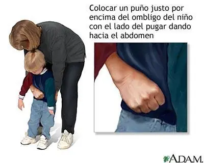 primeros auxilios