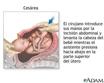 primeros auxilios