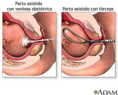 sistemas