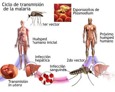 primeros auxilios