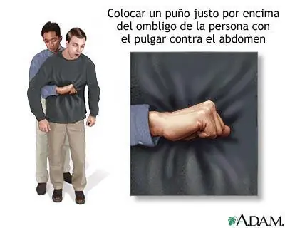 enfermedades