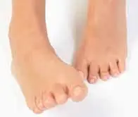 Trucos