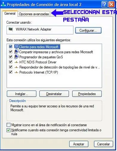xp