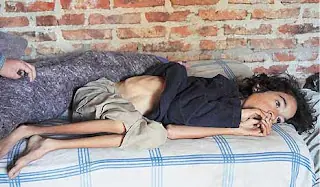 chaco, pobreza y desnutricion