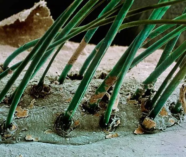 20 Imágenes impresionantes con microscopio