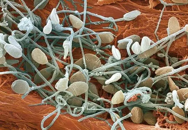 20 Imágenes impresionantes con microscopio [Imperdible]
