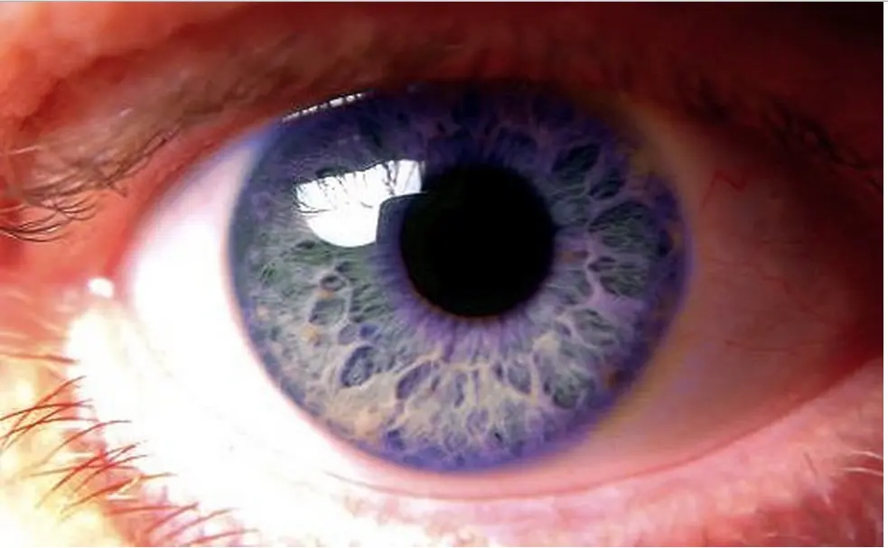 color