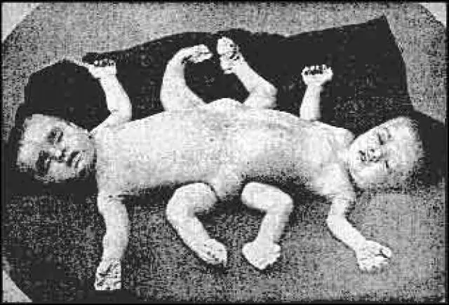 Josef Mengele "El Angel De La Muerte" [MegaPost]