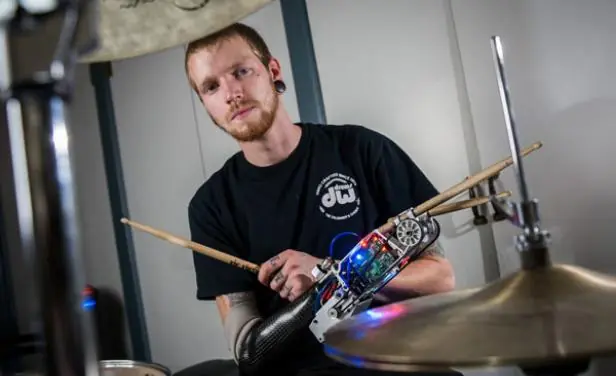 Prótesis robótica: "tercer brazo" a baterista