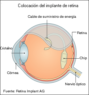 ceguera