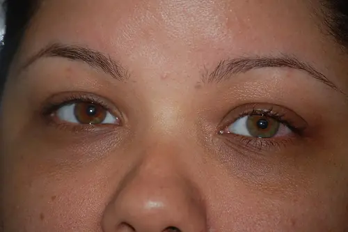 del ojo