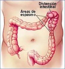alimentacion