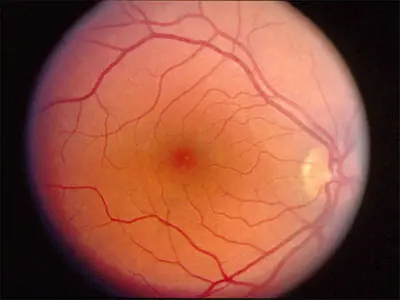 25 curiosidades del ojo humano