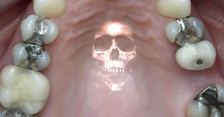 mercurio