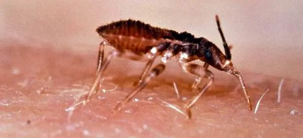 Biogramas para controlar la enfermadad de chagas
