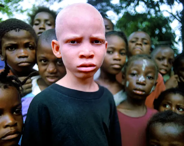 Negros Albinos?