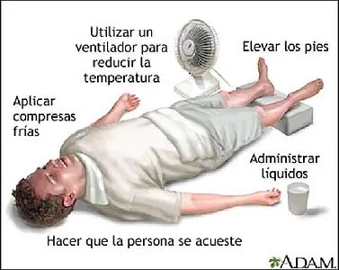Golpe de calor