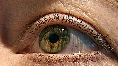 Vision