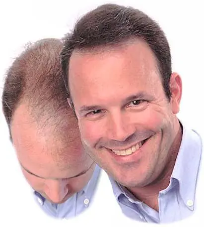 Solucion a la caida cabello.