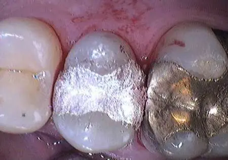 medico