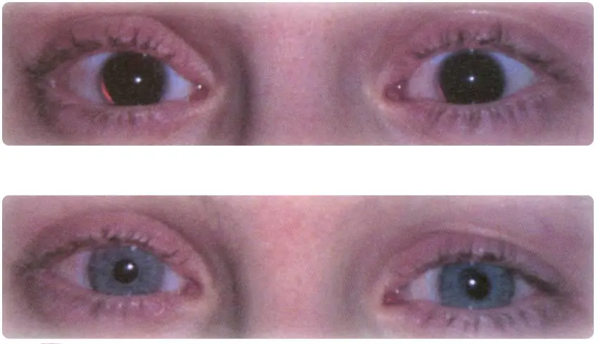 Las enfermedades mas raras