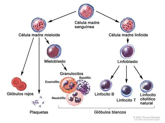 leucemia