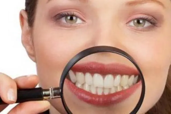 Mi experiencia con los brackets (Actualizable)