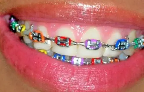 dientes