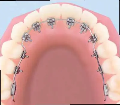 dientes